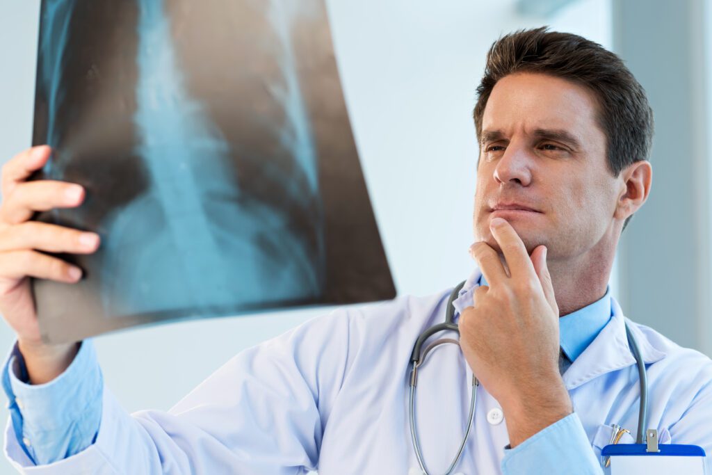 Doctor Thoughtfully Looking at the x-ray